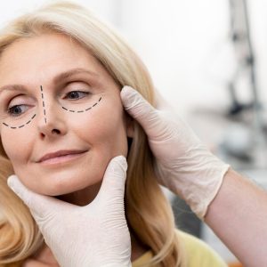 Blefaroplastie totala